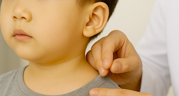 6세 이하 영유아 교통사고 후유증, 자생 치료 후 절반 이상 감소 (SCI급 국제학술지 게재) - 자생의료재단