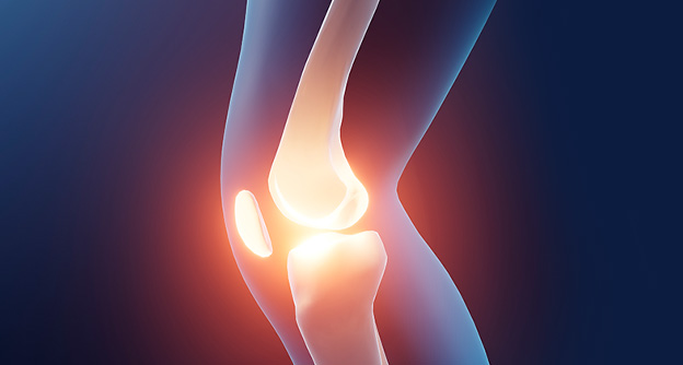 놓치기 쉬운 무릎 통증 원인, '혈당'부터 확인하세요! - 자생의료재단